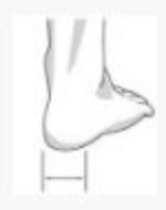 MALLEOLOC ENKELBRACE extra 3